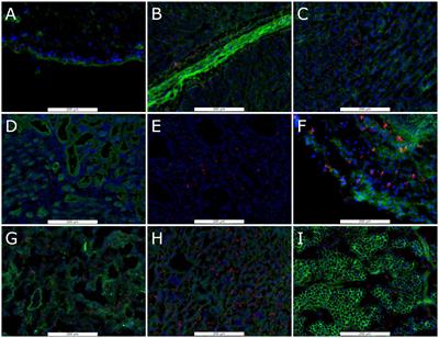 PRRSV-2 viral load in critical non-lymphoid tissues is associated with late gestation fetal compromise